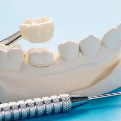 a dental crown over a model of teeth